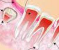 Applications of Dental Stem Cells for Regenerative Medicine in Oral Surgical Procedures