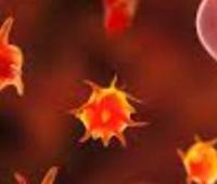 Immune Thrombocytopenic Purpura: a Case Report