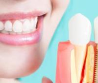 The Use of Dental Stem Cell Therapy in the Treatment of Gum Deterioration