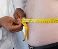  Impacts of Obesity in the Hospital Environment: The Case of the Nurse