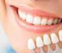 Effect of One 30-Minute Application of a Non-Peroxide Dental Whitening Strip: A Clinical Study in 50 Subjects