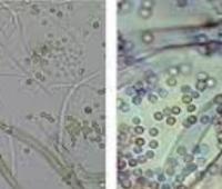 Antifungal Susceptibility Pattern of Seed Exracts of Ricinodendron Heudelotii (njangsa) on Candida Albicans and Aspergillus Niger