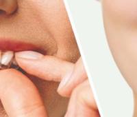 The Impact of Clear Aligner Therapy on Periodontal Health Compared to Traditional Braces