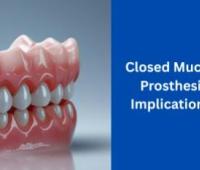 Closed Mucosal Adaptation in Dental Prosthesis: Mechanisms, Clinical Implications, And Future Directions