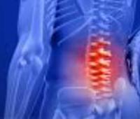 Correlation Between Clinical and Imaging Findings in Lumbar Magnetic Resonance in Patients with Chronic Low Back Pain: A Systematic Analysis