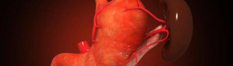 Hepatoduodeno Pancreatectomy for Biliary Tract Cancers: Report of 